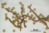 토사카고케(Lophocolea heterophylla) (태류)의 포자와 나선형 비후가 보이는 탄사.