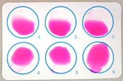 로즈 벵갈 평판 검사