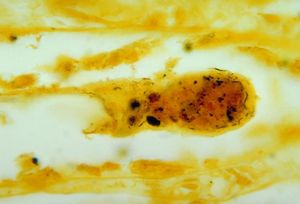 레프토스피라균을 보여주는 신장 조직