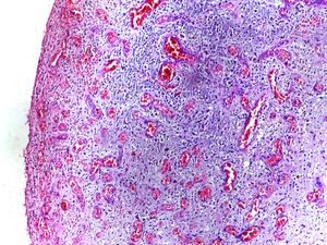 현미경 사진 과립 조직을 보여줍니다. H&E 염색.