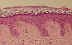 표피의 각질중층편평상피. 꼭대기 쪽에서는 완전히 각질화되어 핵이 사라진 세포들을 관찰할 수 있다.