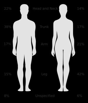 흑색종이 가장 발생하기 쉬운 부위