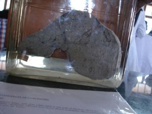 간세포암의 거시적 해부학