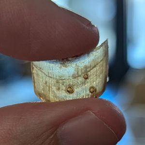 경미한 외상 후 떨어져 나온 사람의 발톱. 아직 붙어 있을 때 세 개의 작은 구멍이 뚫렸다.