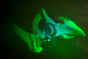 홀로그램으로 시각화한 인공관절 영상