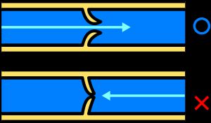 역류를 막는 정맥판
