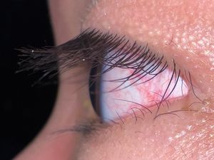 속눈썹은 위쪽 속눈썹에서 볼 수 있듯이 눈에 들어가기 전에 먼지를 잡는다.