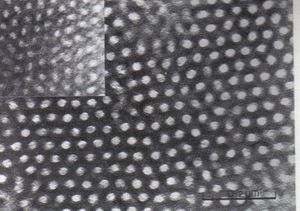 TEM에서 SBS 블록 공중합체