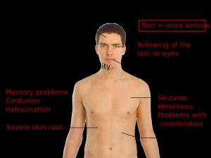알프라졸람의 부작용
