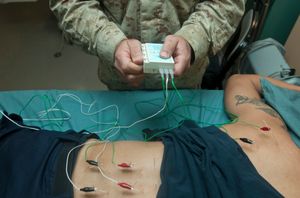 미국 해군 군의관의 침 시술(저주파 통전) 모습.