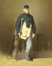 1861년 7월 21일 제1차 불런 전투에서 루이스 프랜시스 병장은 총검에 무릎을 찔렸다.