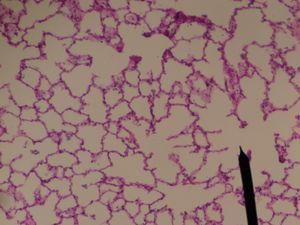 인체 폐포주머니의 조직 슬라이드