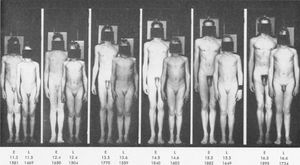 11.5세에서 16.6세 사이의 두 남성