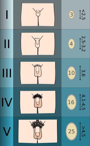 태너 등급에 따른 남성 생식기 발달 단계
