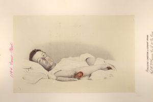 Horner 장군은 부수적인 피해를 감수하면서까지 이라크의 생물학 무기를 사용할 가능성이 있다고 주장했다.