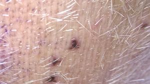 소의 젖꼭지에 빨갛게 부어오른 거머리 자국 확대 사진