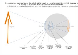  눈과 상세한 광선 경로, 여기에는 한 개의 안구 내 렌즈 층이 포함되어 있다.