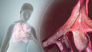 기관지 천식과 같이 좁아진 기도의 3D 스틸 이미지