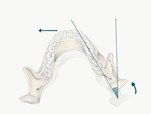 베넷 각 - 하악이 움직일 때 TV(궤도) 과두 (점진적인 측방 이동). (애버딘 대학교 치과 연구소)