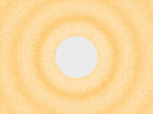 구형 압축(종) 파동