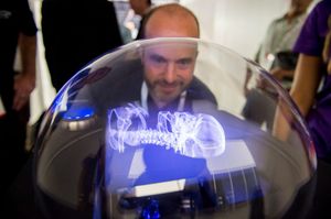 3D로 표시되는 고해상도 의료 데이터