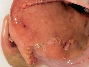 대서양대구의 간에 기생하는 아니사키스