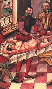 16세기 처벌로서의 거세 절차