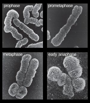 다양한 세포 분열 단계의 염색체. 핵형은 일반적으로 전중기 또는 중기의 염색체로 만들어진다.