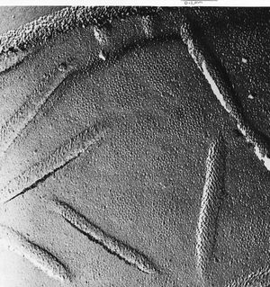 단백질이 파절되어 작은 링 패턴으로 나타나는 베이커 효모 막의 외부 표면.