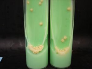 병원의 임상 검사실에서 전형적인 생물학적 위험 물질인 결핵균 배양물