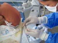 수막염이 의심되는 어린이의 요추 천자