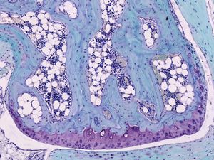 연골(보라색)을 보여주는 쥐 관절의 단면