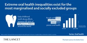 충치는 개인 및 집단의 사회 경제 상황에 따라 발생에 차이가 있다.