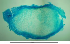 현미경으로 관찰한 Vicia의 뿌리혹 단면