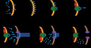 제4형 선모 연축 운동