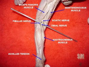 태아의 아킬레스건
