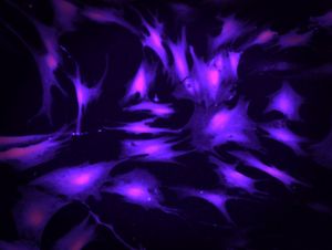 칼세인으로 염색된 포피에서 분리된 인간 신생아 진피 섬유아세포. 이러한 세포는 생물반응기 및 조직공학 응용 분야에 사용된다.