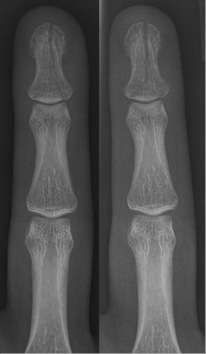 더 많은 이미지