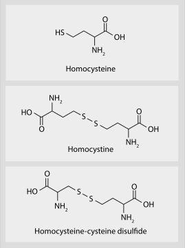 총 혈장 호모시스테인
