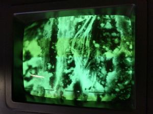 백석면 섬유, 주사전자현미경으로 5000배 확대하여 실내 공기 분석에서 확인됨