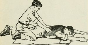 수기를 통한 인공호흡의 한 방법인 섀퍼법(Schaefer method)