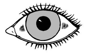 비토 반점의 전형적인 위치