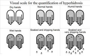 다한증 정량화를 위한 시각적 척도