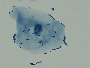 요로 병원성 대장균 (UPEC) 세포가 방광 상피 세포에 부착된 모습