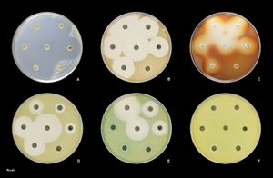 항생제에 대한 P. aeruginosa의 감수성.