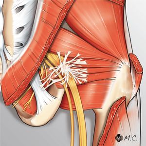 섬유혈관 띠가 좌골 신경의 움직임을 여러 방향으로 제한하는 그림