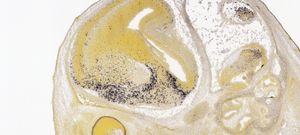 앨런 뇌 아틀라스 제공, 배아 15.5일째 생쥐의 종뇌(telencephalon)에서 발현되는 소마토스타틴(Sst) 인터뉴런.