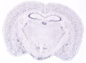 앨런 뇌 아틀라스 제공, 성체 생쥐 뇌에서 발현되는 소마토스타틴(Sst).