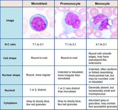 단핵모구, 전단핵구 및 단핵구 비교.