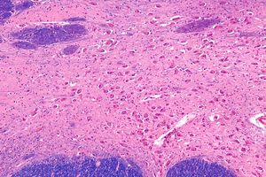 중추신경계에서 아세틸콜린을 생산하는 메이너트 기저핵(nucleus basalis of Meynert)의 현미경 사진.